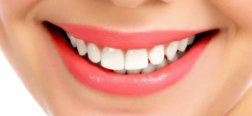 5 найпоширеніших запитань про здоров'я зубів.